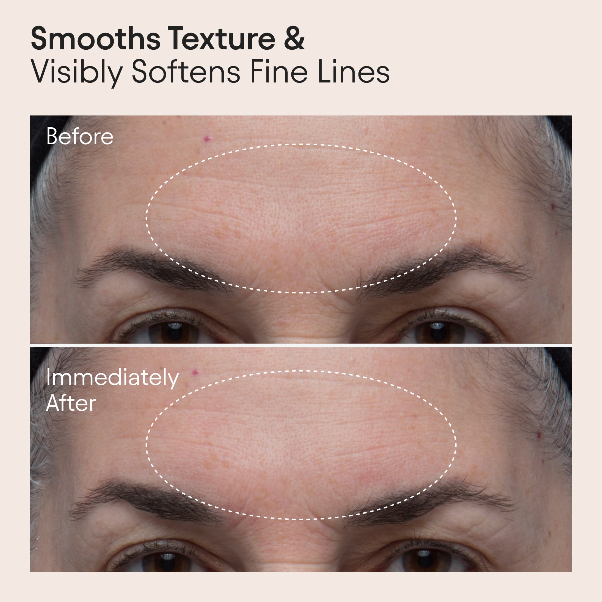 Double Polishing Peel