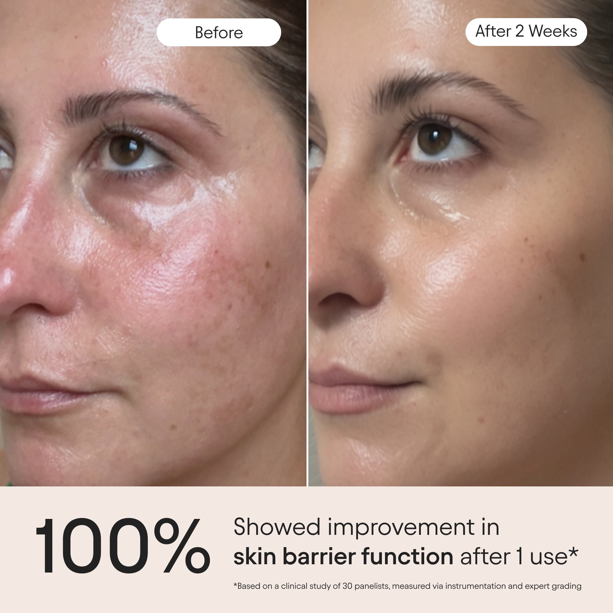 3-in-1 Barrier Repair Serum
