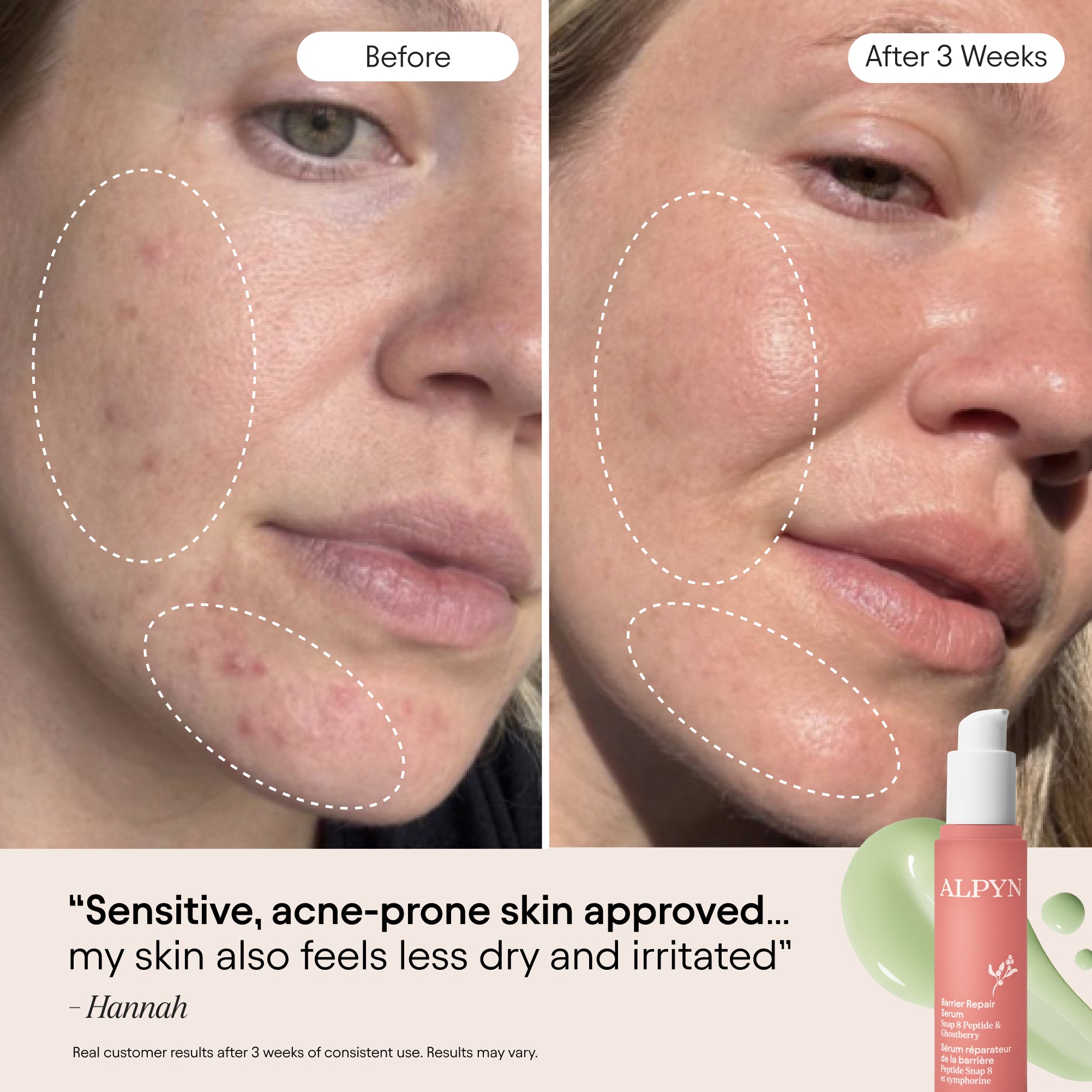 3-in-1 Barrier Repair Serum
