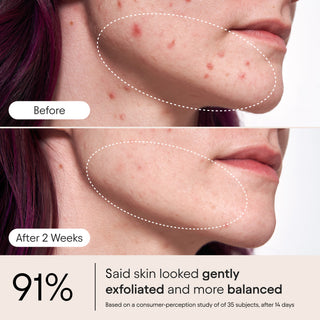 Pore Perfecting Liquid