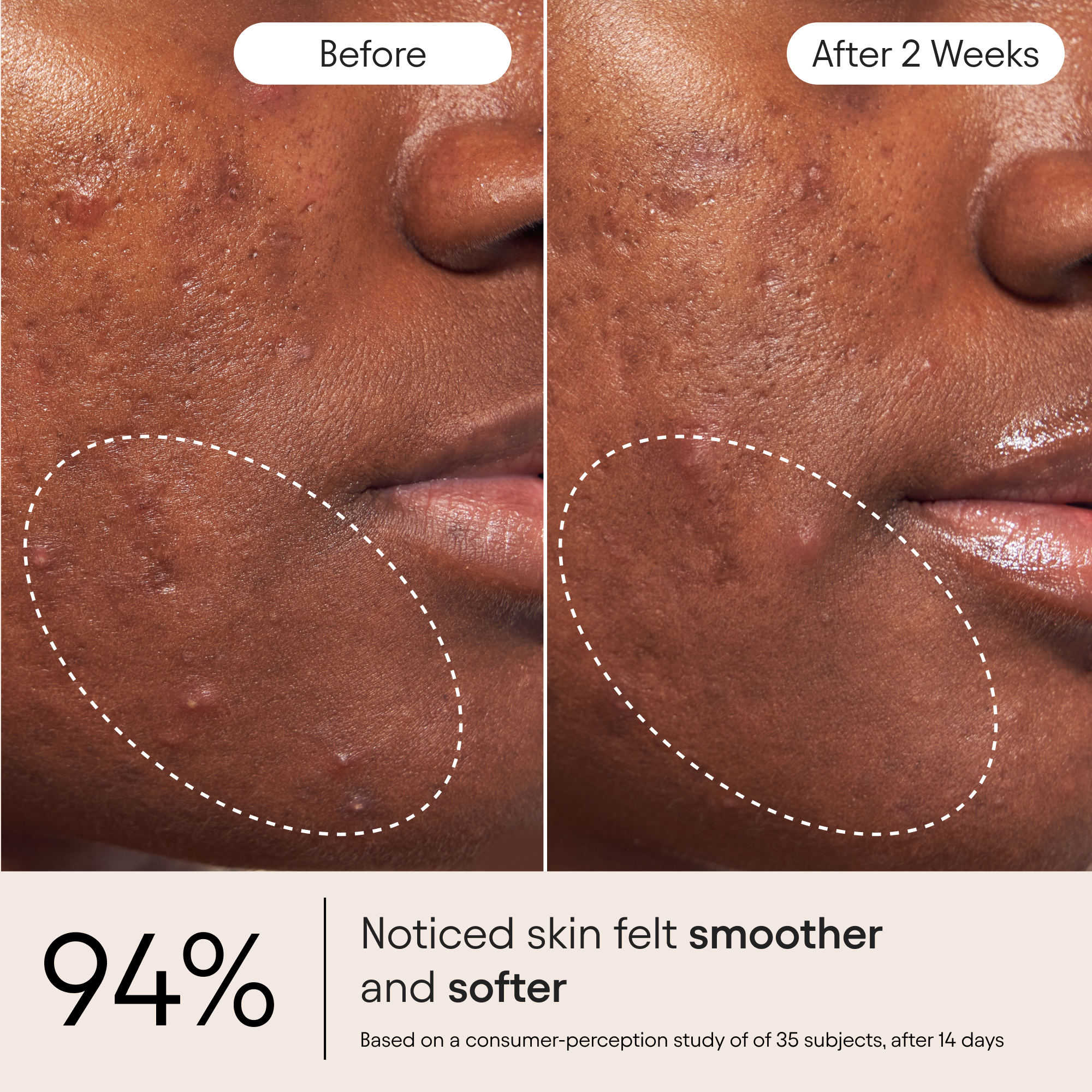 Pore Perfecting Liquid