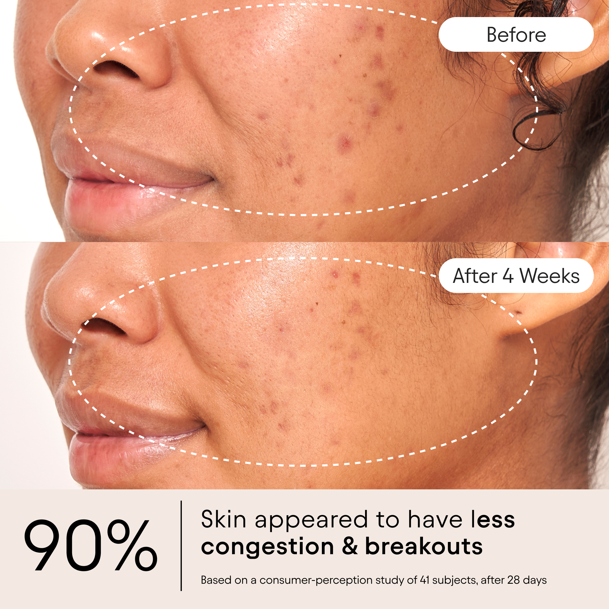 Clarifying Facial Oil