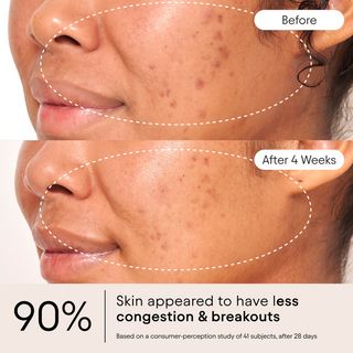 Clarifying Facial Oil