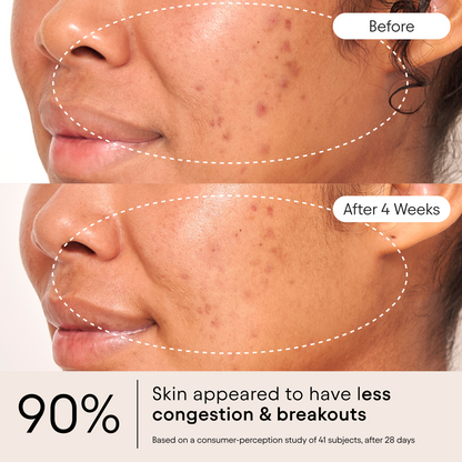 Clarifying Facial Oil
