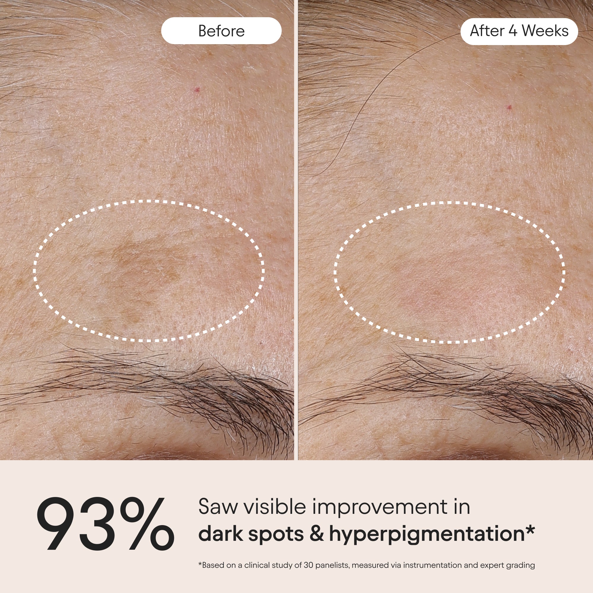 3-in-1 Barrier Repair Serum
