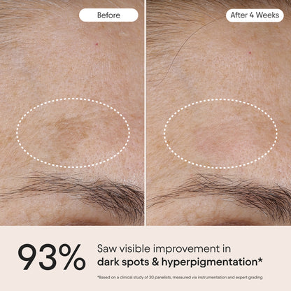 3-in-1 Barrier Repair Serum