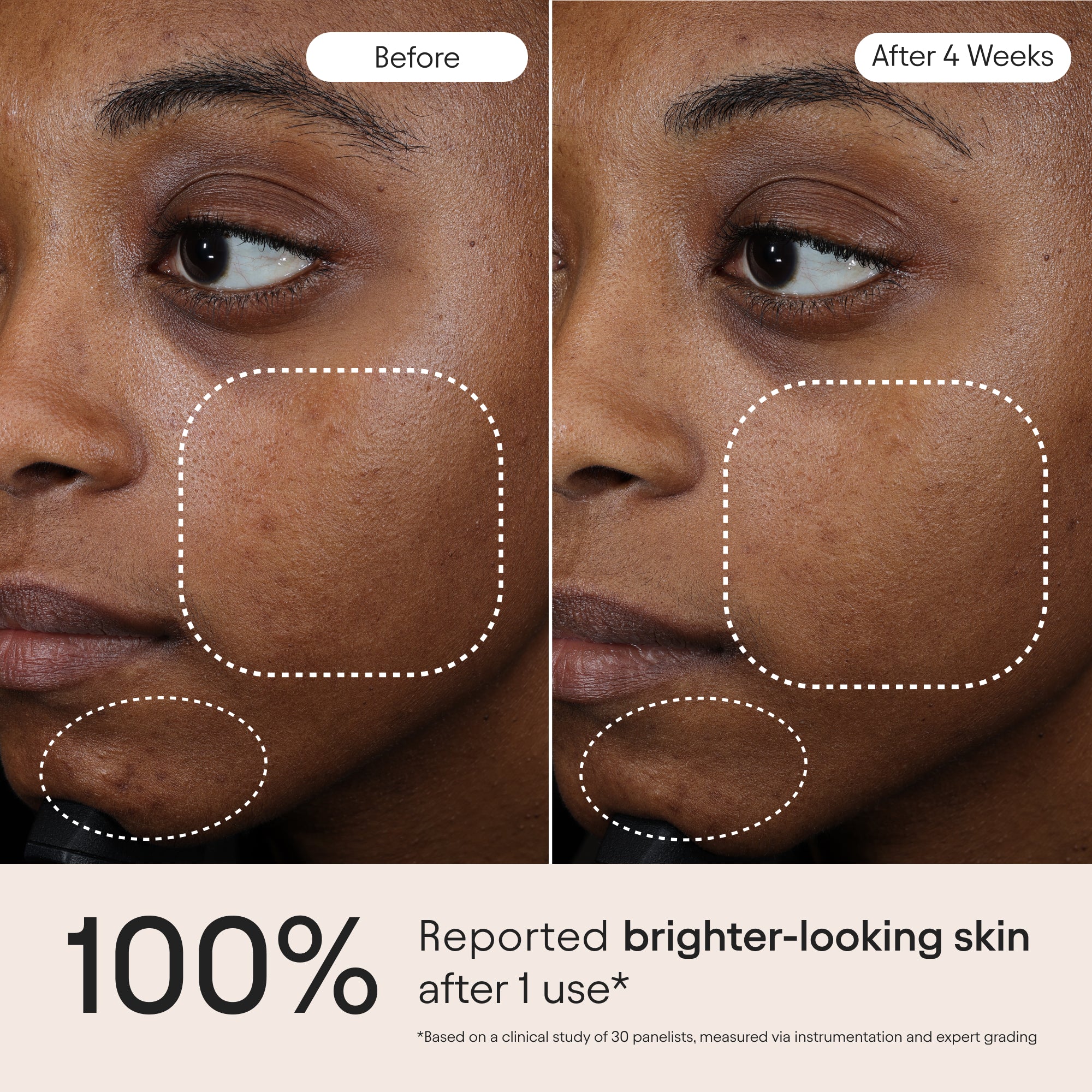 3-in-1 Barrier Repair Serum