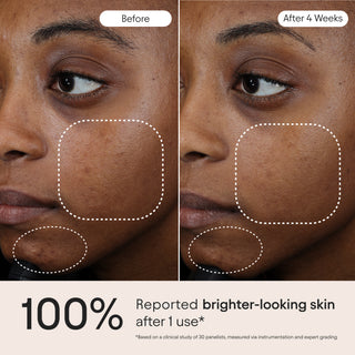 3-in-1 Barrier Repair Serum (Launches 8/25)
