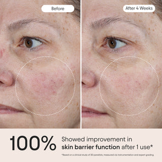3-in-1 Barrier Repair Serum (Launches 8/25)