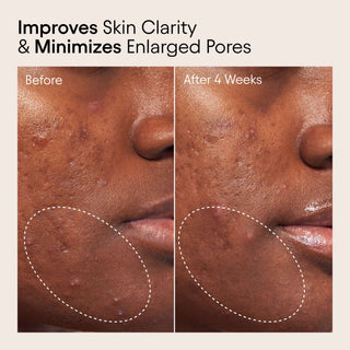 Clear Skin Starter Set
