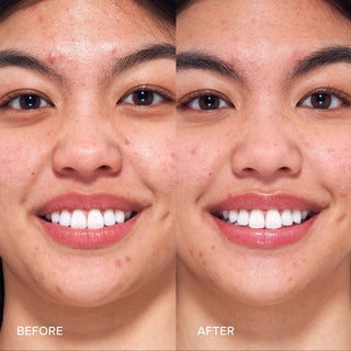 Pore Perfecting Liquid Exfoliator with 2% BHA + Borage